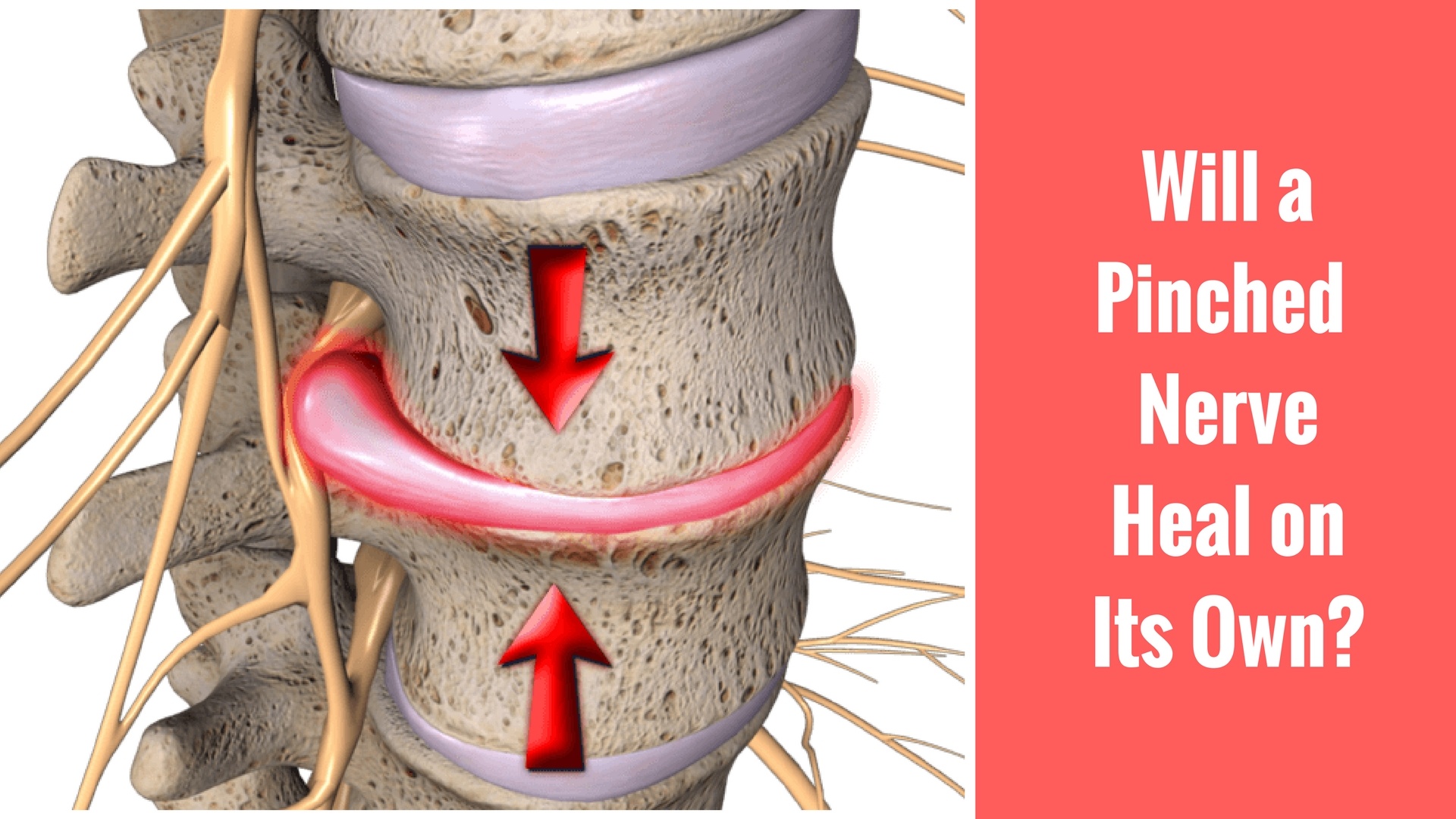 Will a Pinched Nerve Heal on Its Own? SpineCare - St. Joseph, MI  Chiropractor
