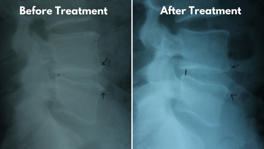 Spinal Therapy SpineCare and Chiropractic Center