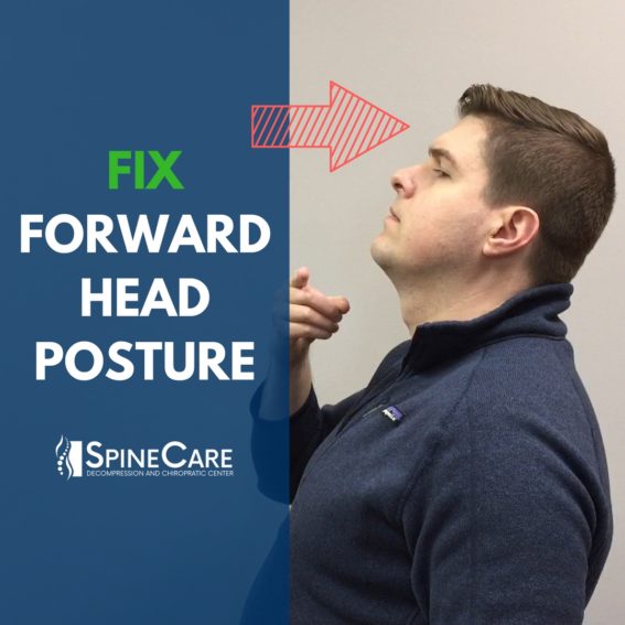 Forward Head Posture