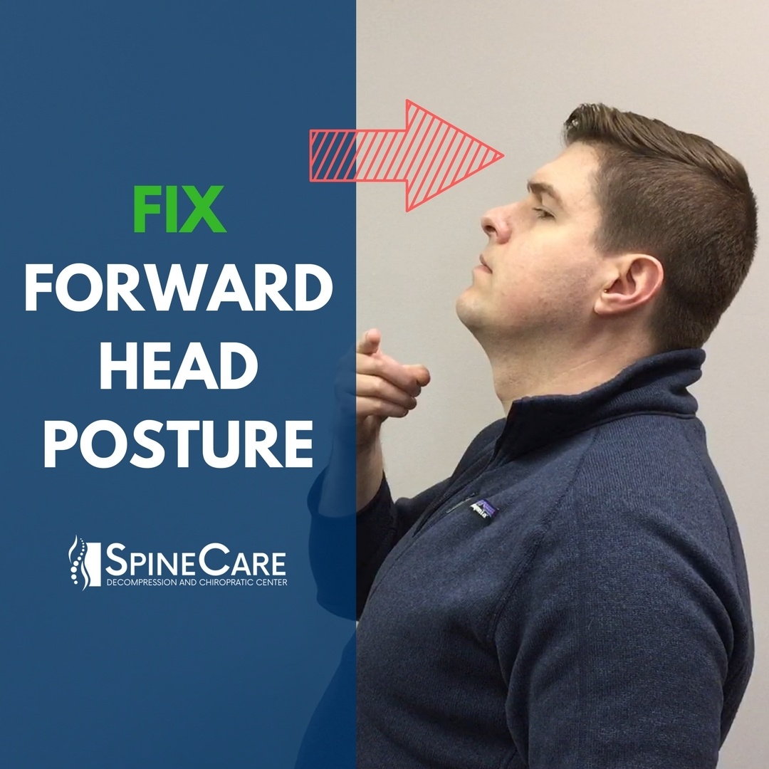Fix Forward Head Posture SpineCare Chiropractic in St. Joseph, MI
