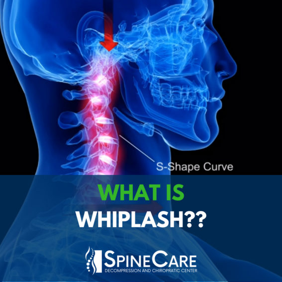What is Whiplash St. Joseph MI Chiropractor
