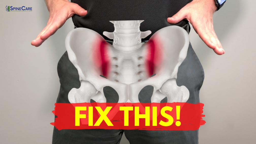 Dr. Rowe shows how to fix sacroiliac joint pain FOR GOOD! | SpineCare | St. Joseph, Michigan Chiropractor