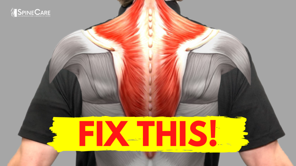 How to Fix Muscle Knots in Your Neck and Shoulder in 30 SECONDS | SpineCare | St. Joseph, Michigan Chiropractor
