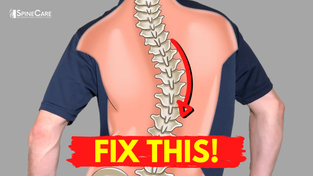 How to Relieve Your Scoliosis Back Pain in 30 SECONDS | SpineCare | St. Joseph, Michigan Chiropractor