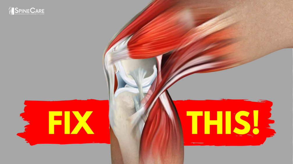 How to Fix Knee Pain for Good (AT HOME!) | SpineCare | St. Joseph, Michigan Chiropractor