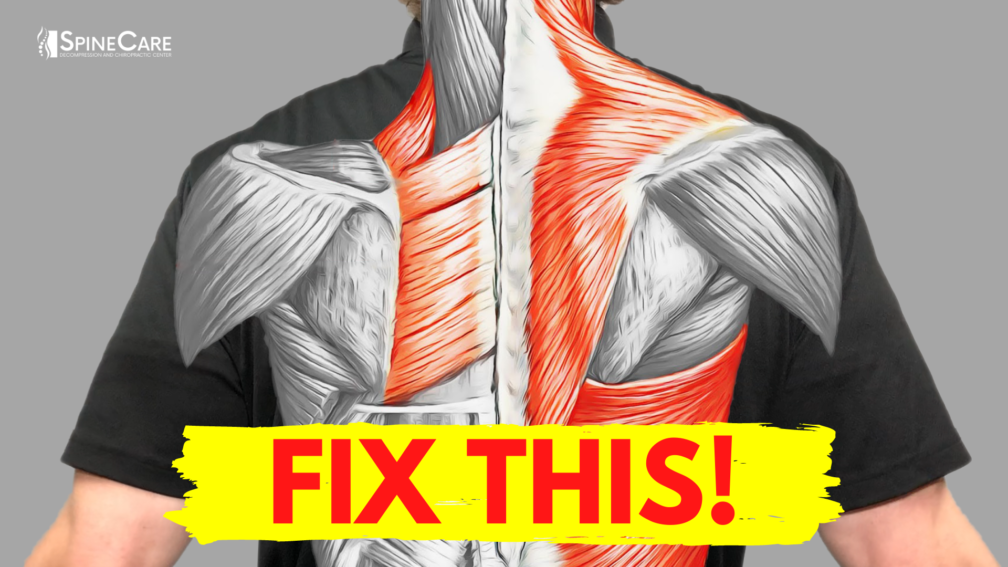 How to Fix Muscle Pain Between Your Shoulder Blades for Good | SpineCare | St. Joseph, Michigan Chiropractor