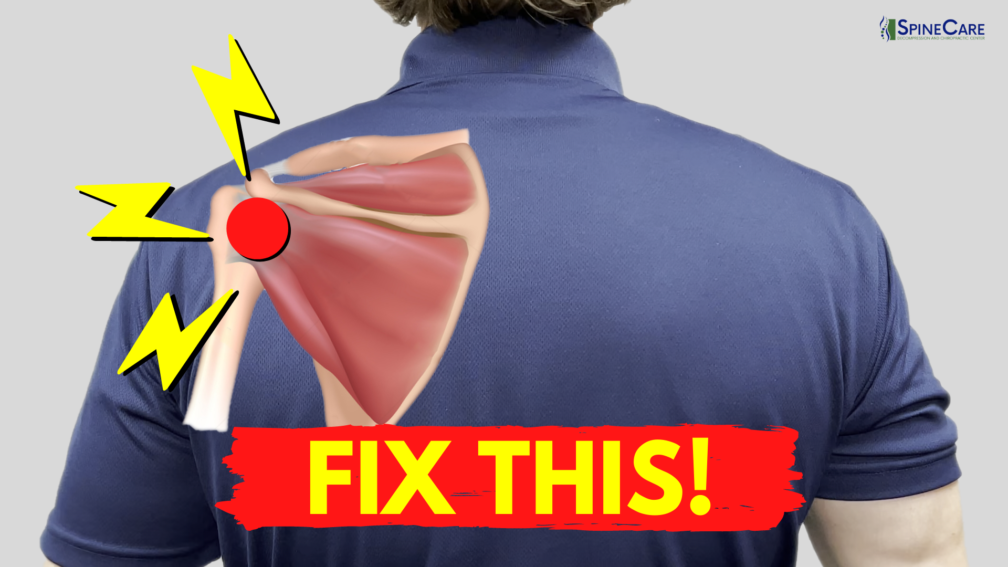How to Fix Shoulder Snapping and Pop Sounds (NO EQUIPMENT!) | SpineCare | St. Joseph, Michigan Chiropractor