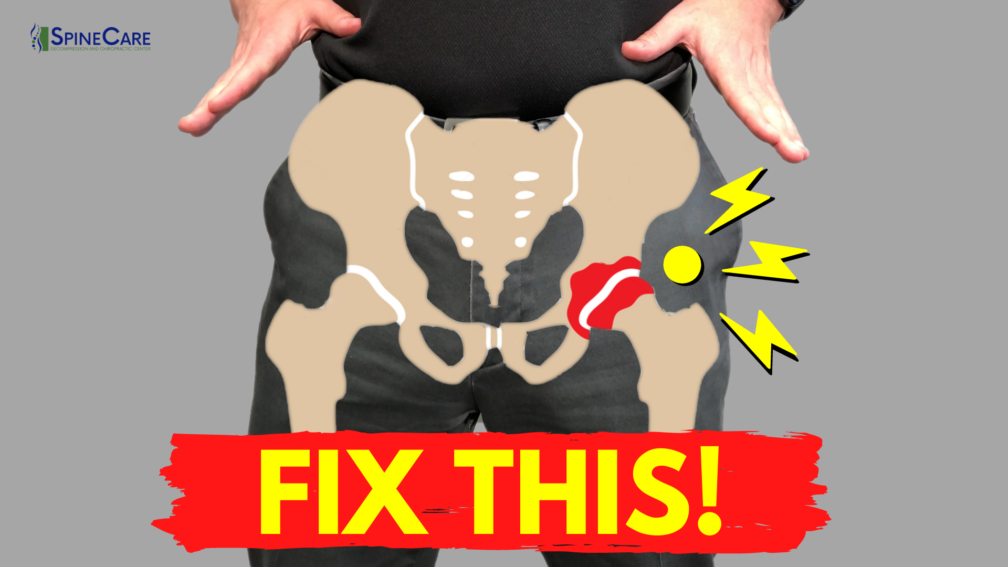 How to Fix a Popping Hip for Good (NO EQUIPMENT!) | SpineCare | St. Joseph, Michigan Chiropractor