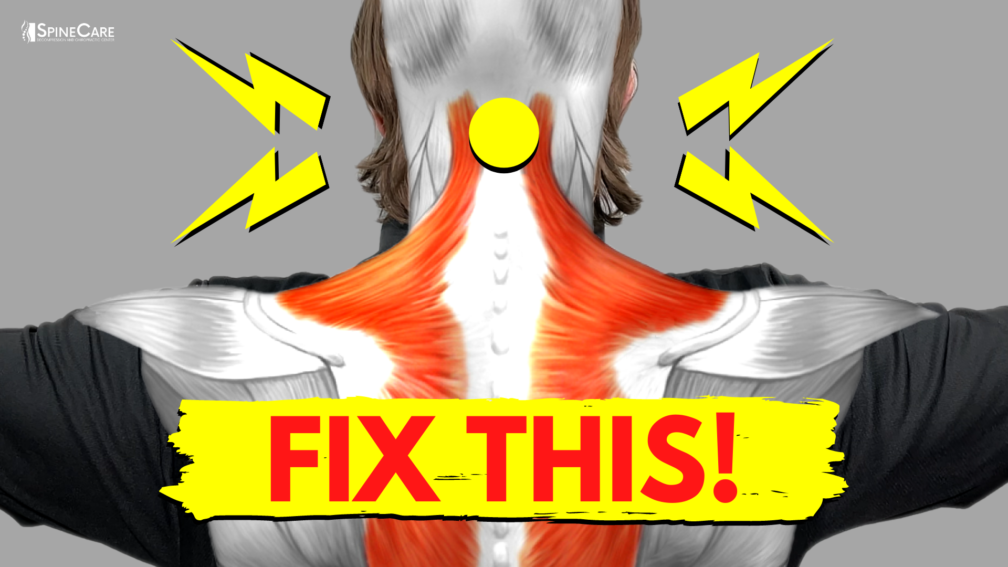 How to Fix a Snapping and Popping Neck | SpineCare | St. Joseph, Michigan Chiropractor