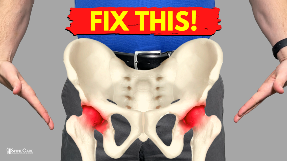 How to Relieve Stiff Hips AT HOME | SpineCare | St. Joseph, Michigan Chiropractor