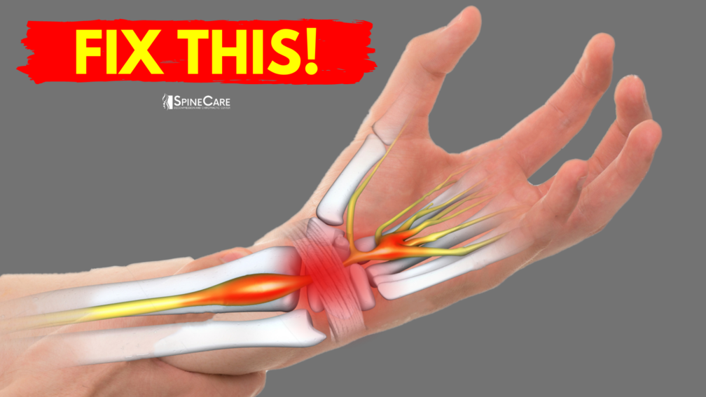 How to Fix Wrist Pain for Good | SpineCare | Saint Joseph, Michigan Chiropractor
