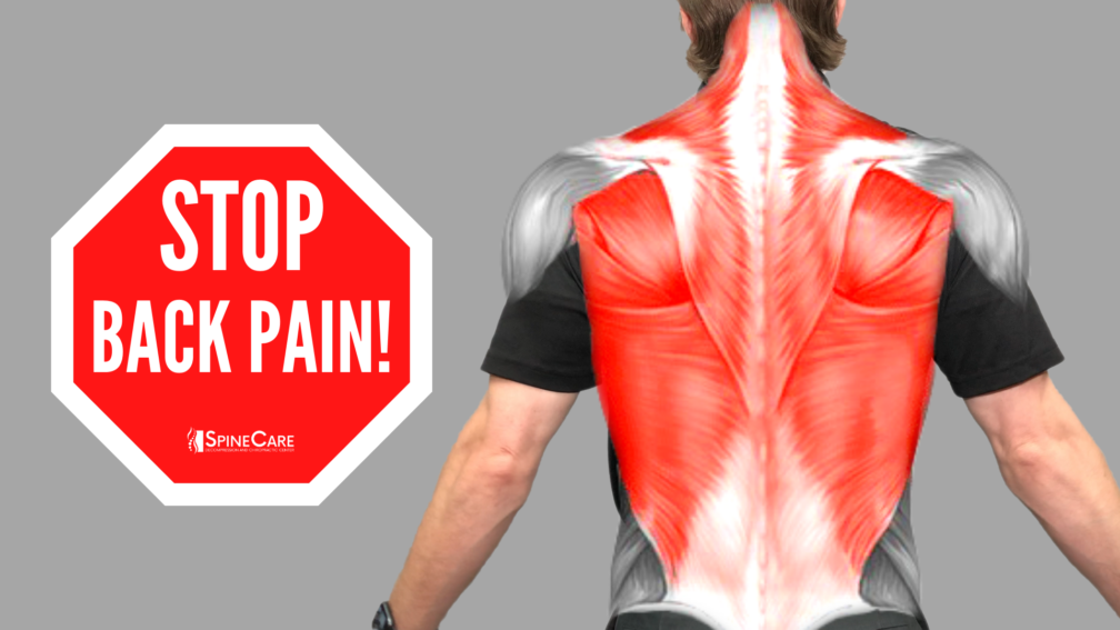 How to Relieve Your WHOLE BACK Pain in Seconds | SpineCare | St. Joseph, Michigan Chiropractor