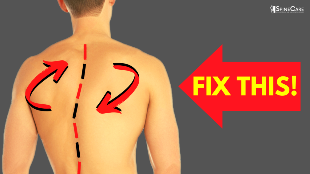 How to Fix a Twisted Back | SpineCare | St. Joseph, Michigan Chiropractor