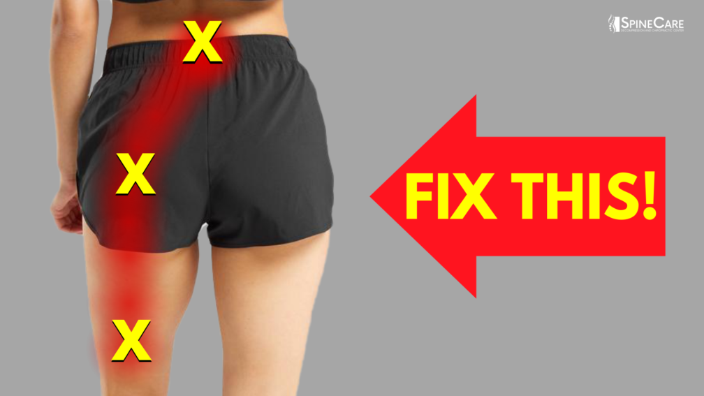 How to Instantly Relieve Nerve Pain in Your Back and Leg | SpineCare | St. Joseph, Michigan Chiropractor