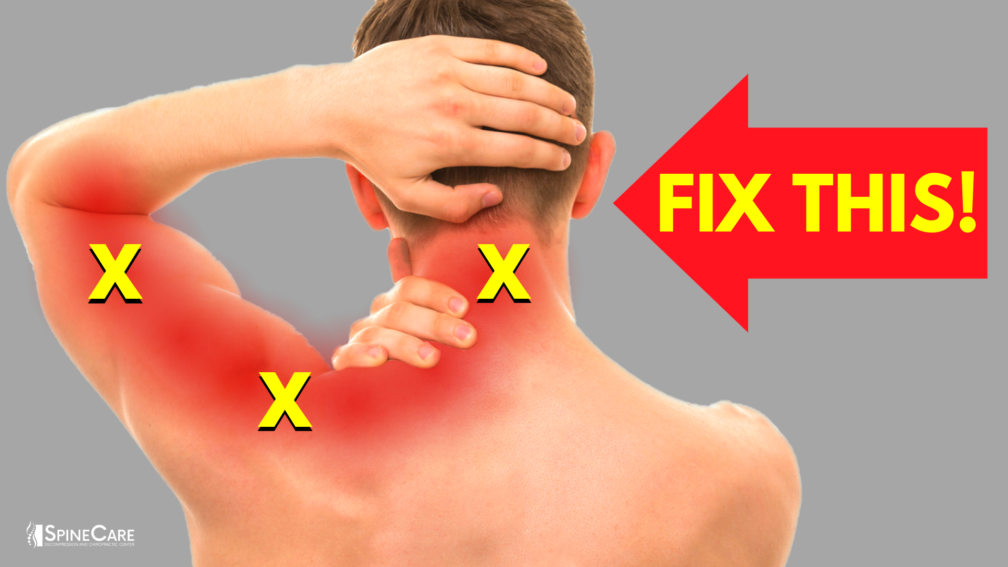 How to Instantly Relieve Nerve Pain in Your Neck and Arm | SpineCare | St. Joseph, Michigan Chiropractor