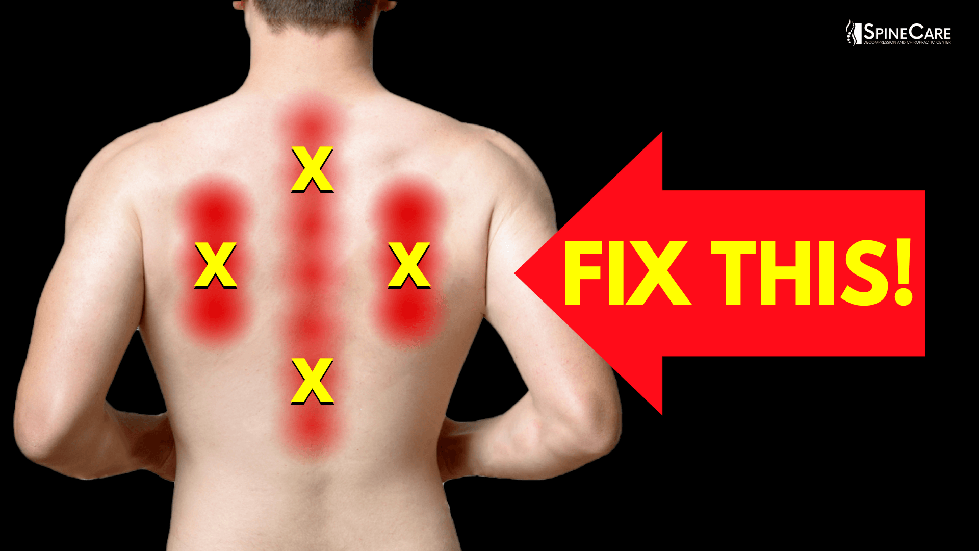 how-to-instantly-relieve-nerve-pain-in-your-upper-back-spinecare