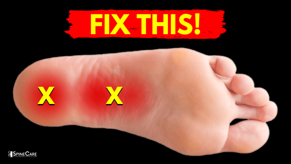 How to Relieve PLANTAR FASCIITIS Pain in Seconds | SpineCare | St. Joseph, Michigan Chiropractor