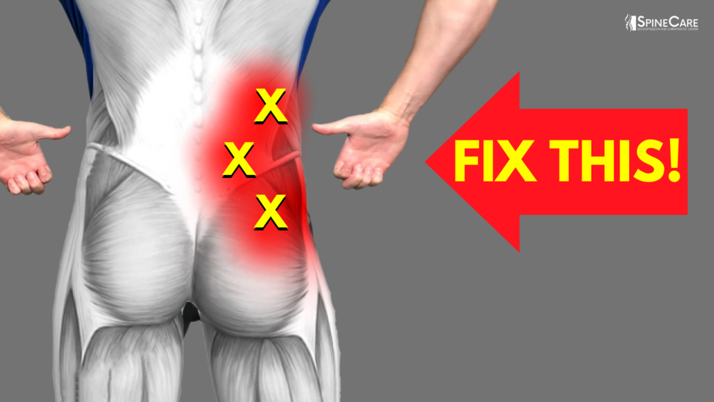 How to Fix Lower Back Pain off to the Side | SpineCare | St. Joseph, Michigan Chiropractor