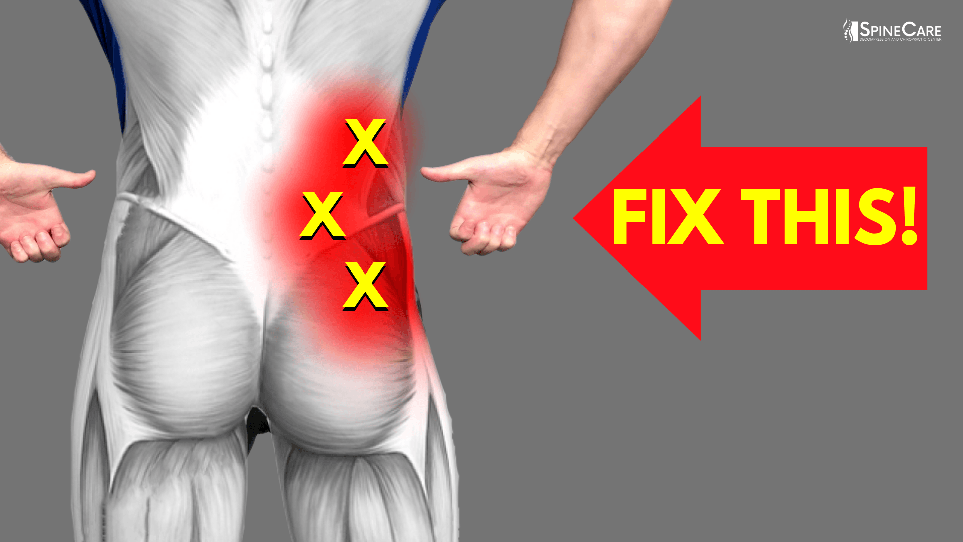 Lower fix. How to Fix lower back Pain. Fix lower back. Before it’s irreversible.