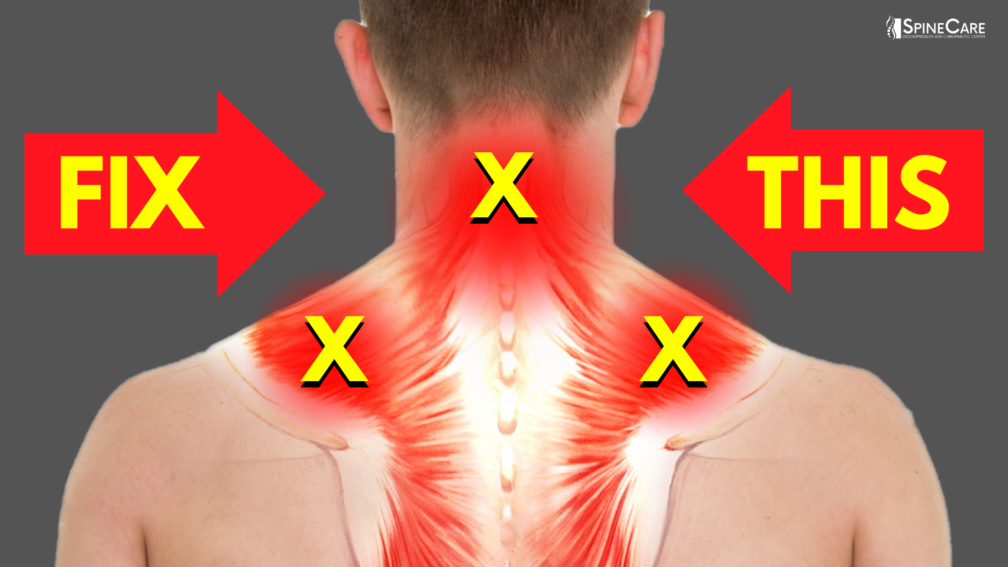 How to Fix a Sore Neck and Shoulders in Seconds | SpineCare | St. Joseph, Michigan Chiropractor