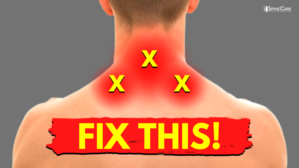 How to Quickly Relieve Pain at the BASE OF THE NECK | SpineCare | St. Joseph, Michigan Chiropractor