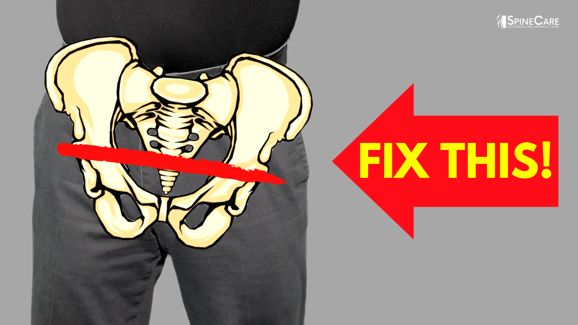How to Get Rid of a High Hip for Good | SpineCare | St. Joseph, Michigan Chiropractor