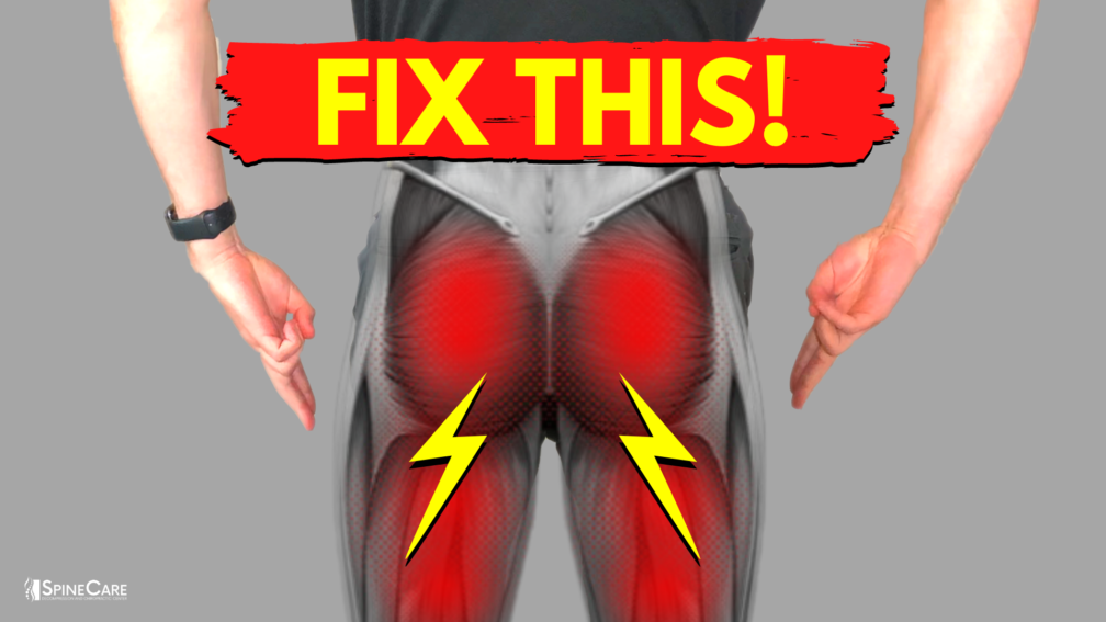 How to Relieve Sciatica Pain in BOTH LEGS | SpineCare | St. Joseph, Michigan Chiropractor
