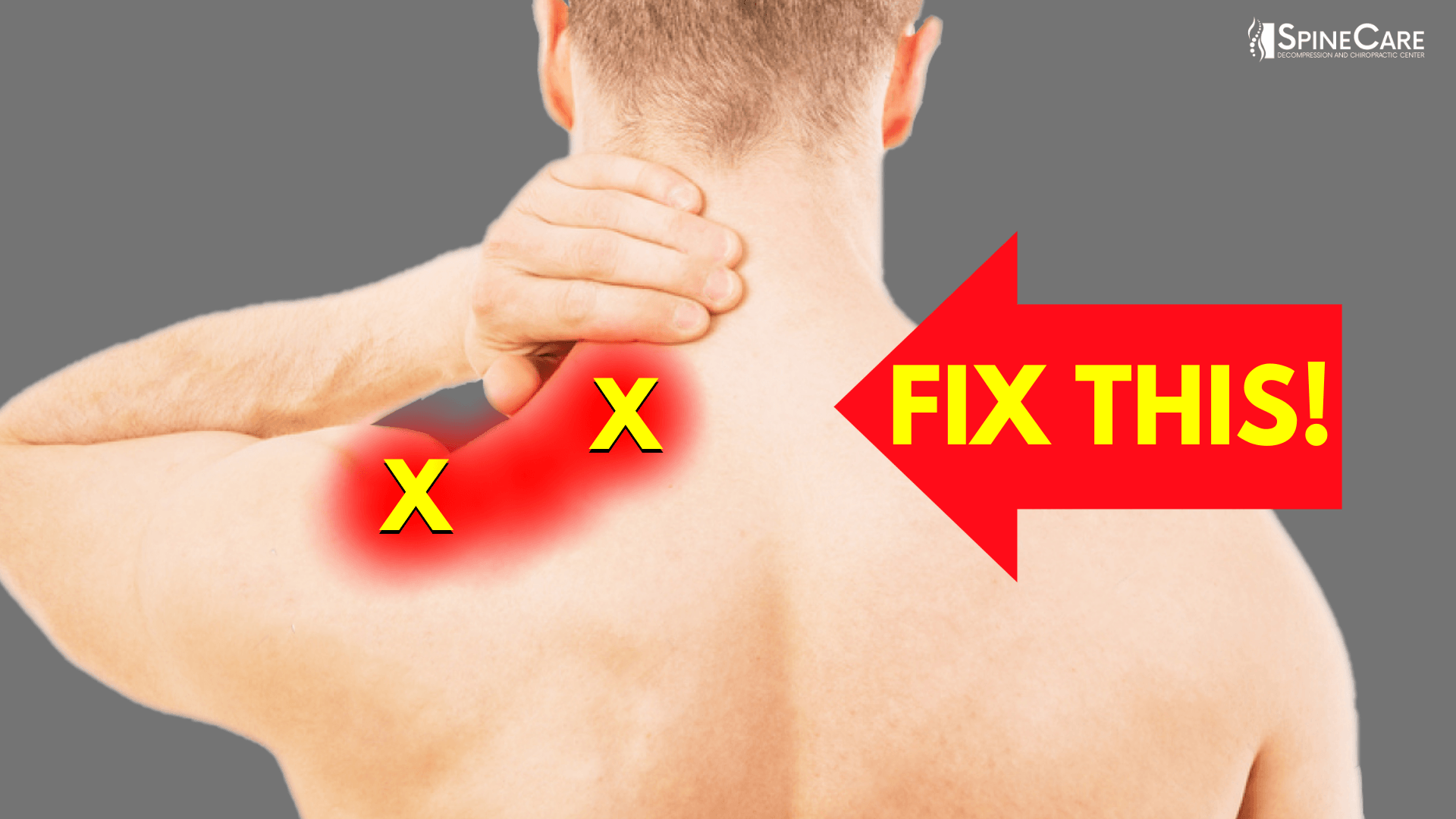 How to Instantly Relieve Nerve Pain in Your Shoulders | SpineCare | St. Joseph, Michigan Chiropractor