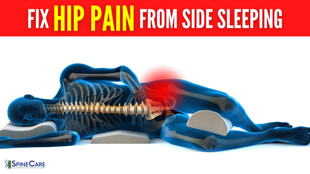 How to Quickly Get Rid of Hip Pain From Side Sleeping | SpineCare | St. Joseph, Michigan Chiropractor