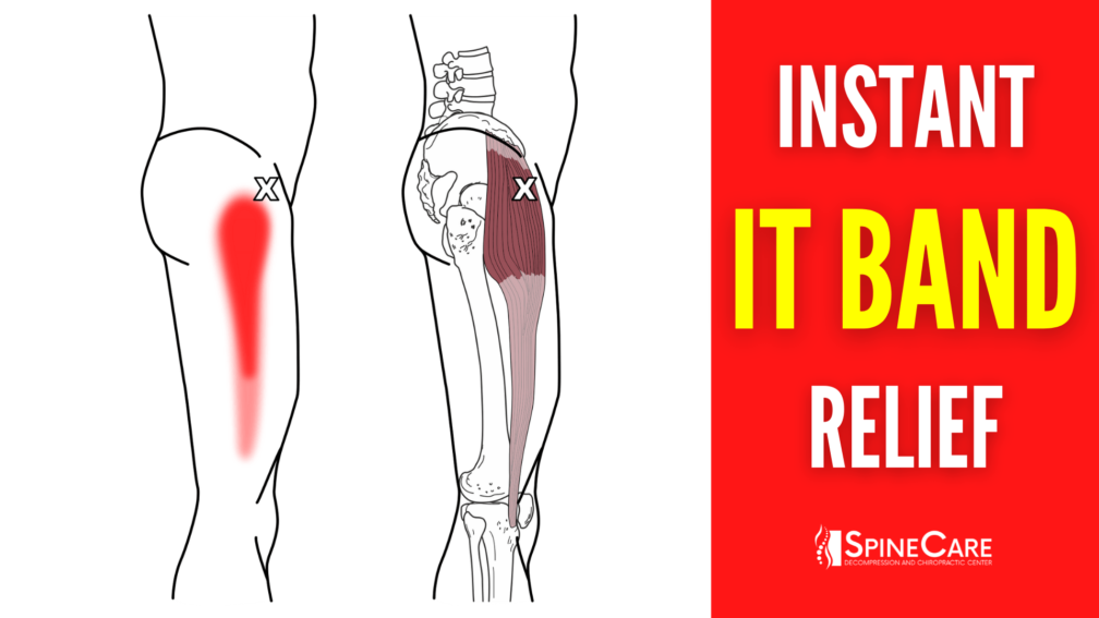 How to Relieve Iliotibial Band Pain FOR GOOD | SpineCare | St. Joseph, Michigan Chiropractor