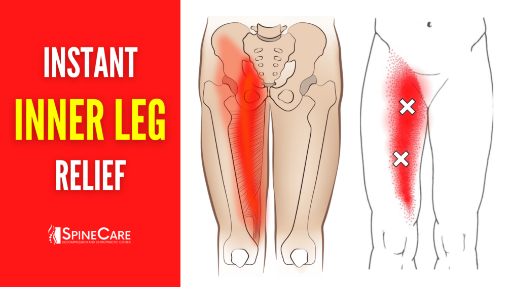 How to Fix Inner Leg Pain FOR GOOD | SpineCare | St. Joseph, Michigan Chiropractor