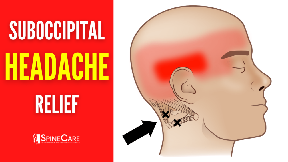 How to Release Tight Suboccipital Muscles