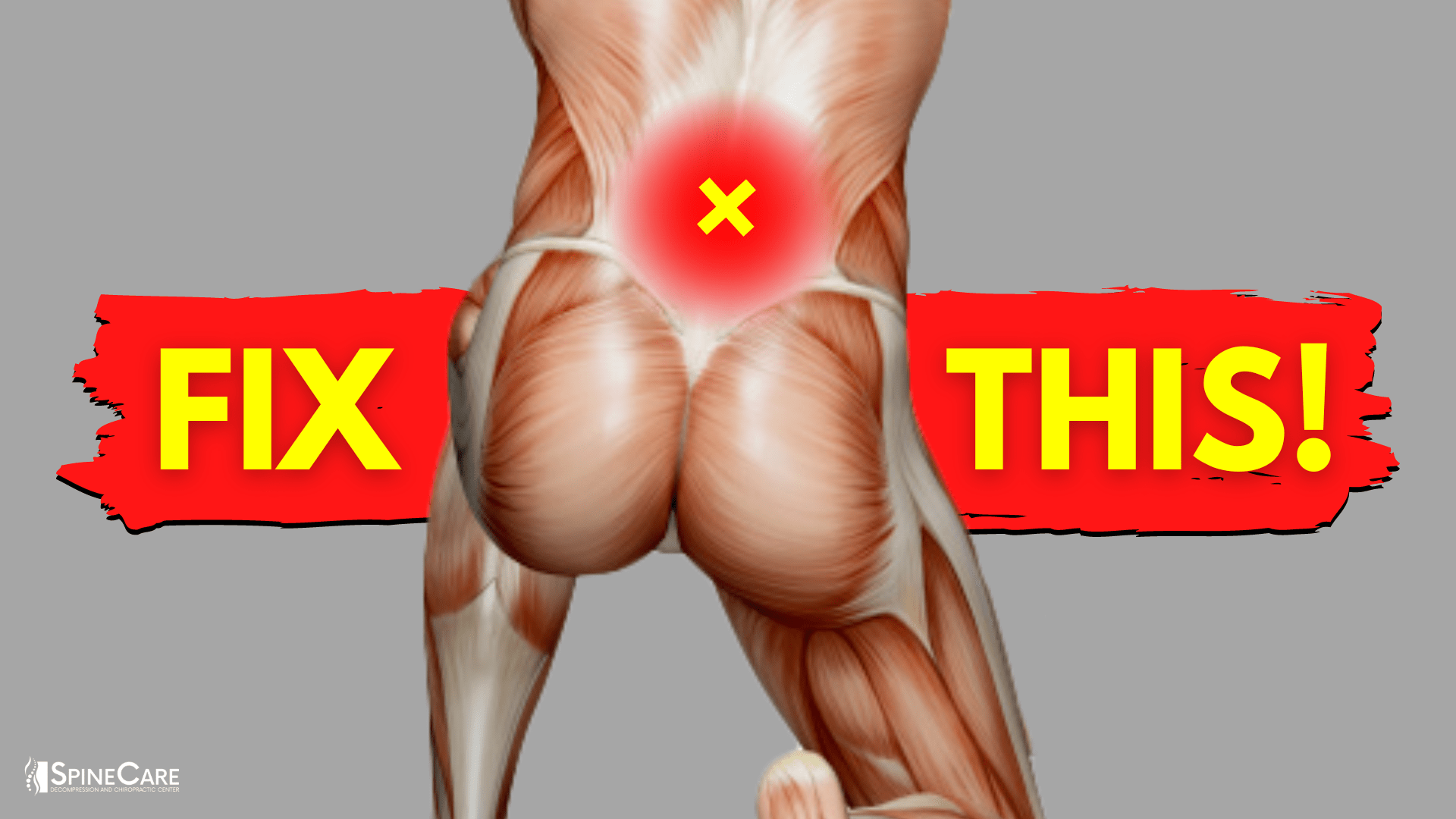 How to Fix Your Lower Back Pain | STEP-BY-STEP Guide | SpineCare | St. Joseph, Michigan Chiropractor
